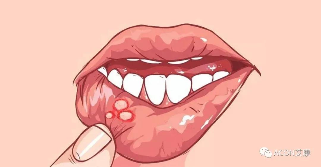 哪些小病容易讓人忽視，最后造成越拖越嚴(yán)重呢？