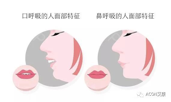 過敏性鼻炎會(huì)讓孩子變傻？！家長(zhǎng)該如何應(yīng)對(duì)